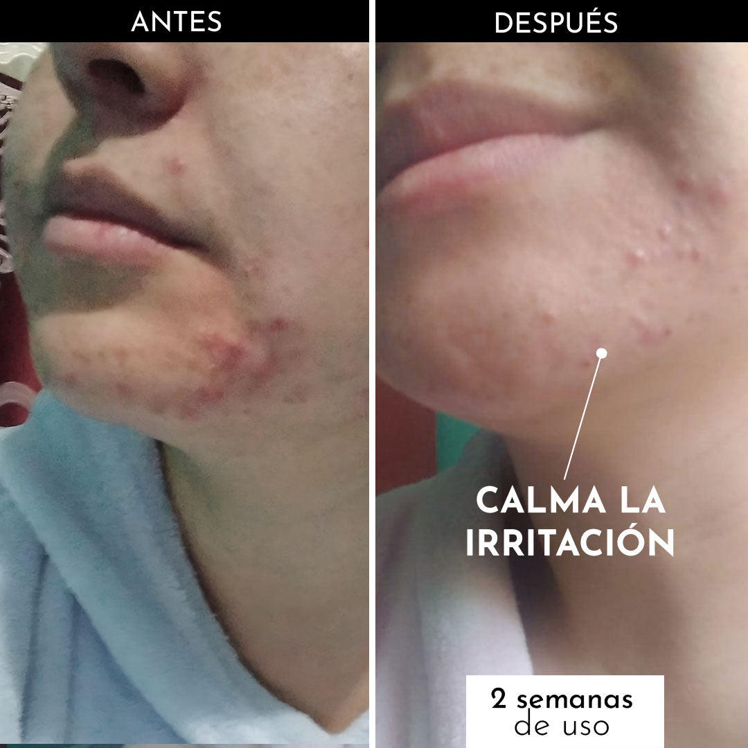 Emulsión Facial Humectante y Nutritiva x50ml